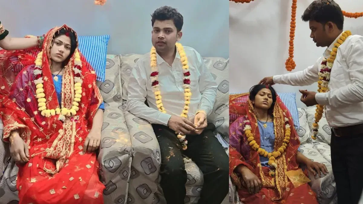 कानपुर: शादी से पहले उबलते तेल से झुलसी दुल्हन, दूल्हे ने अस्पताल के बर्न वार्ड में ही रचाई शादी