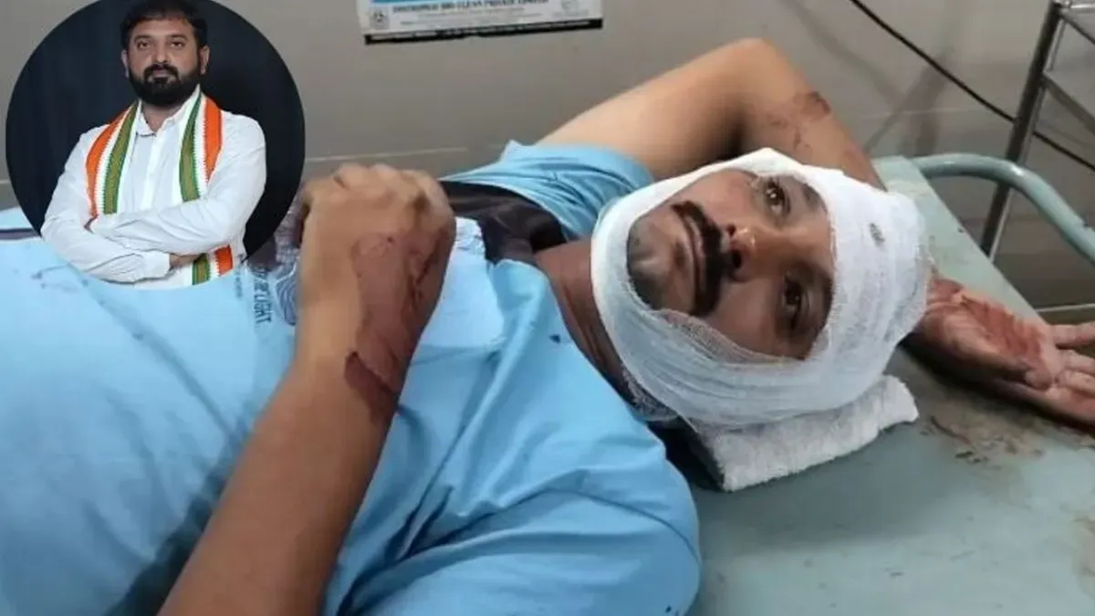 परेश धानाणी के पारिवारिक भाई और अमरेली कांग्रेस शहर अध्यक्ष पर मारपीट का आरोप, युवक के सिर पर किए 5 वार; आए 9 टांके