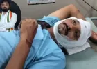 परेश धानाणी के पारिवारिक भाई और अमरेली कांग्रेस शहर अध्यक्ष पर मारपीट का आरोप, युवक के सिर पर किए 5 वार; आए 9 टांके
