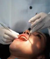 मुँह की सेहत से मस्तिष्क की सुरक्षा: मसूड़ों की बीमारी और स्ट्रोक के बीच नया संबंध