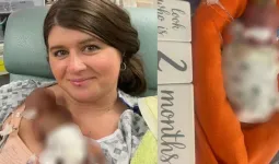 जन्म लेते ही इस बच्चे का नाम गिनीज़ बुक में दर्ज हो गया पहली बार देखकर डॉक्टर भी दंग रह गए।