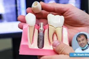 एक दांत खोना आपको आपकी सोच से कहीं ज्यादा नुकसान पहुंचा सकता है