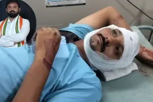 परेश धानाणी के पारिवारिक भाई और अमरेली कांग्रेस शहर अध्यक्ष पर मारपीट का आरोप, युवक के सिर पर किए 5 वार; आए 9 टांके